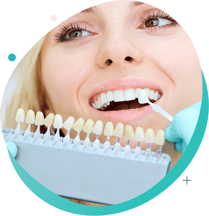 Teeth whitening treatment in our dental clinic in Marrakech or at home