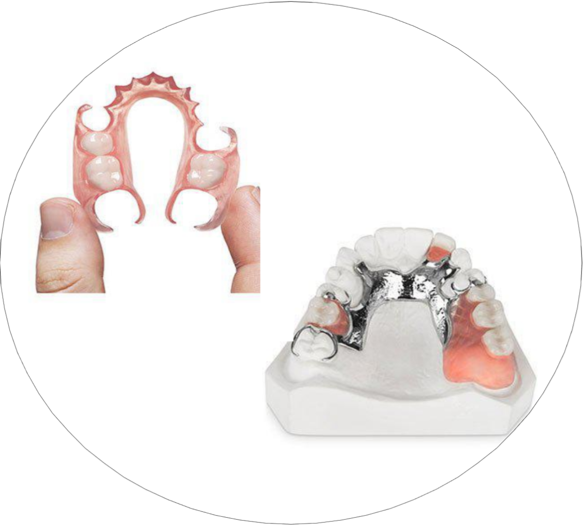 Partial removable prosthesis